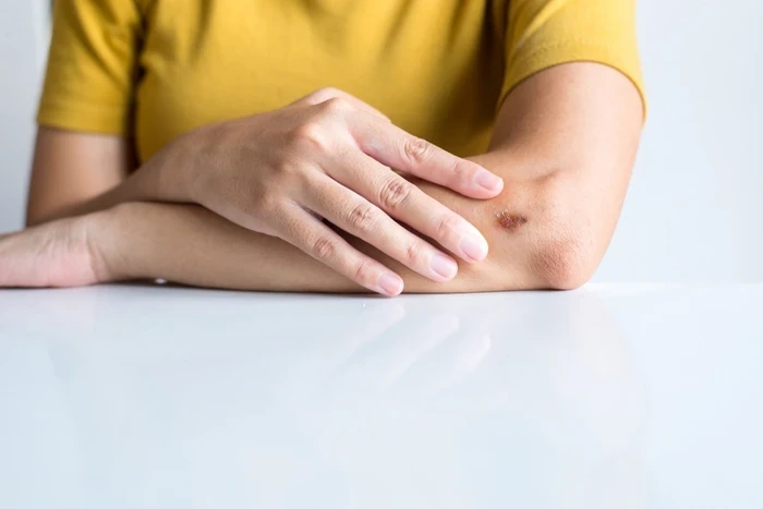 01 woman tapping fingers on arm